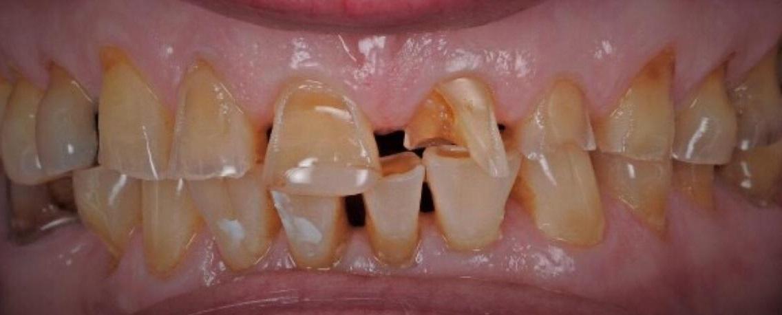 International Dental Hospital Before-After Picture